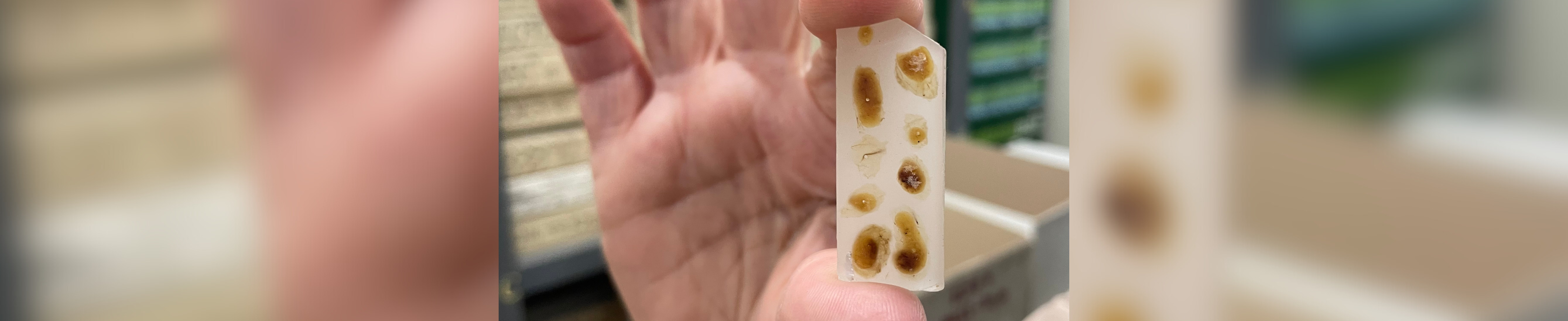 A biopsy sample set in wax