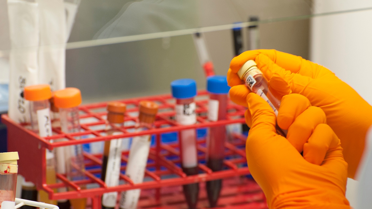 A scientist checking blood samples in a lab