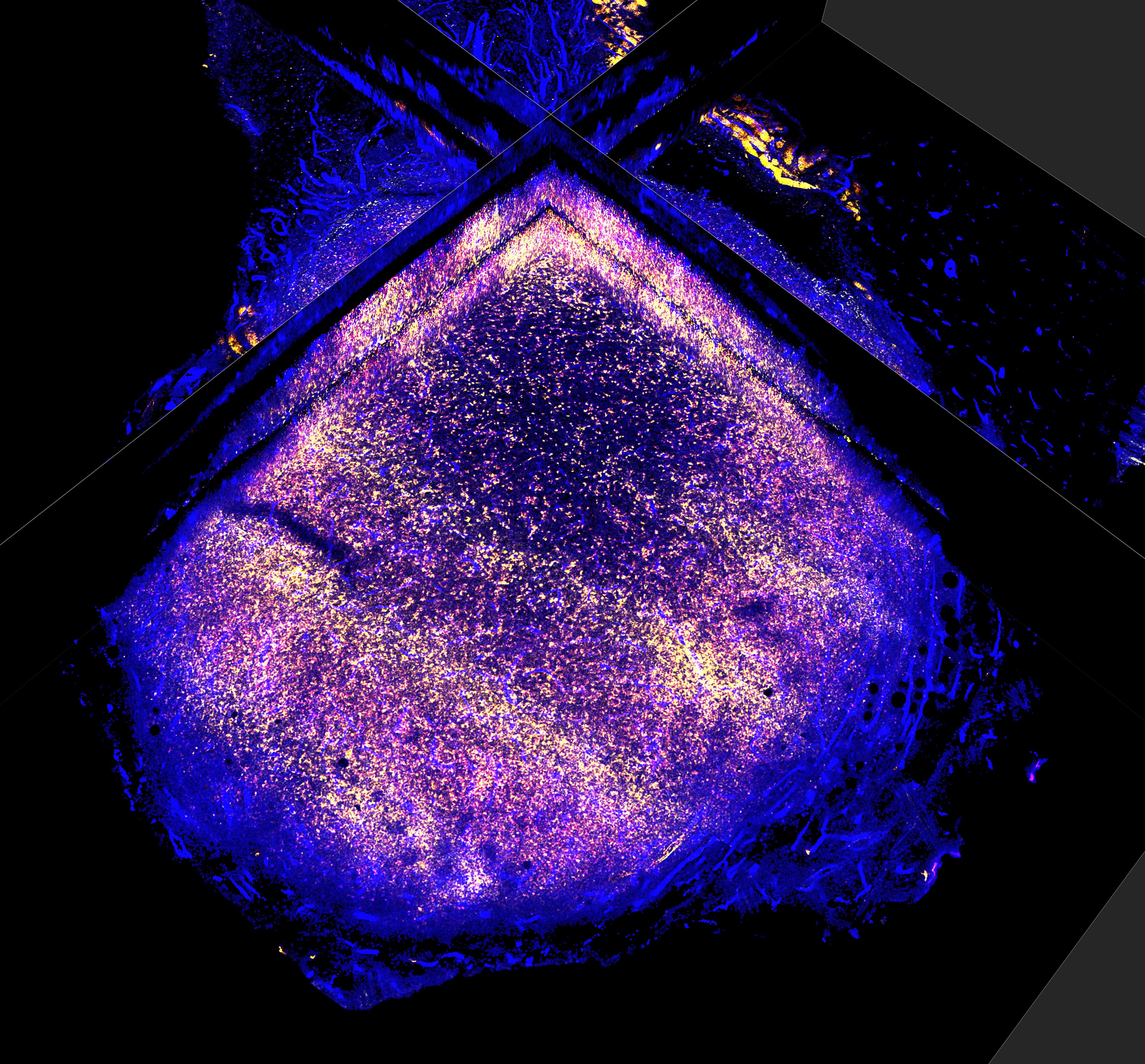 Anti-Tumor Immune Response provided by the National Cancer Institute Visuals Online