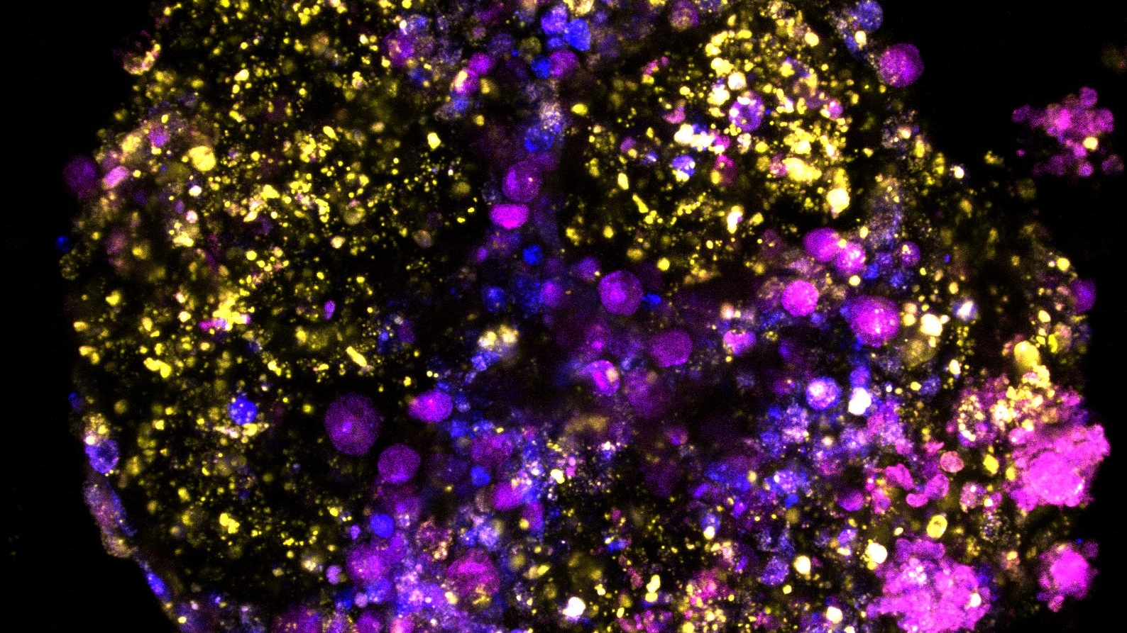 An image of bowel tumour organoids on a black background