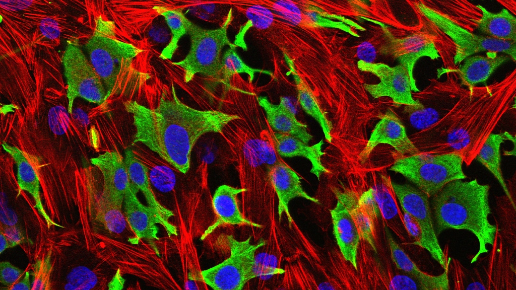 Breast cancer cells. Credit: Luke Henry