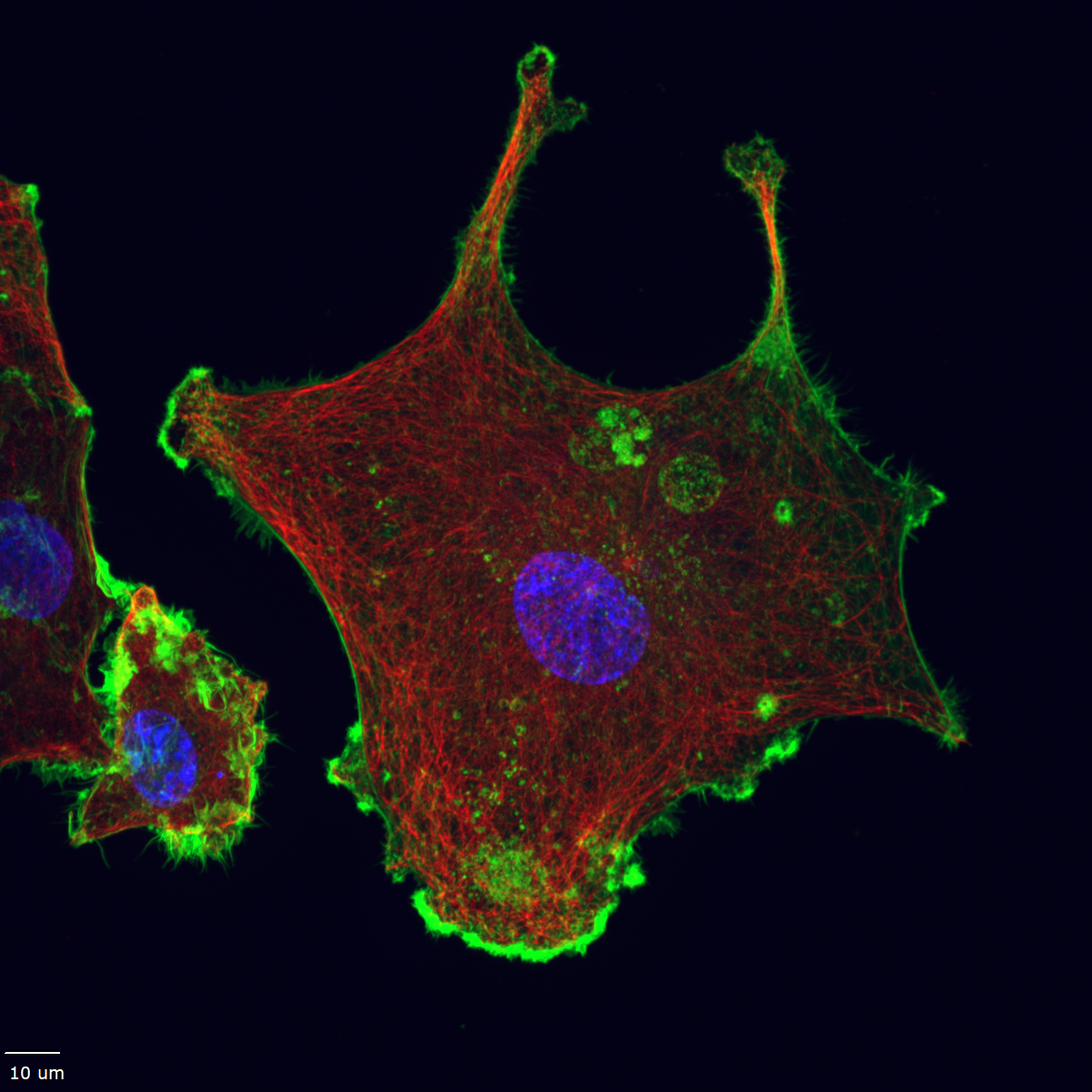 triple negative breast cancer cell