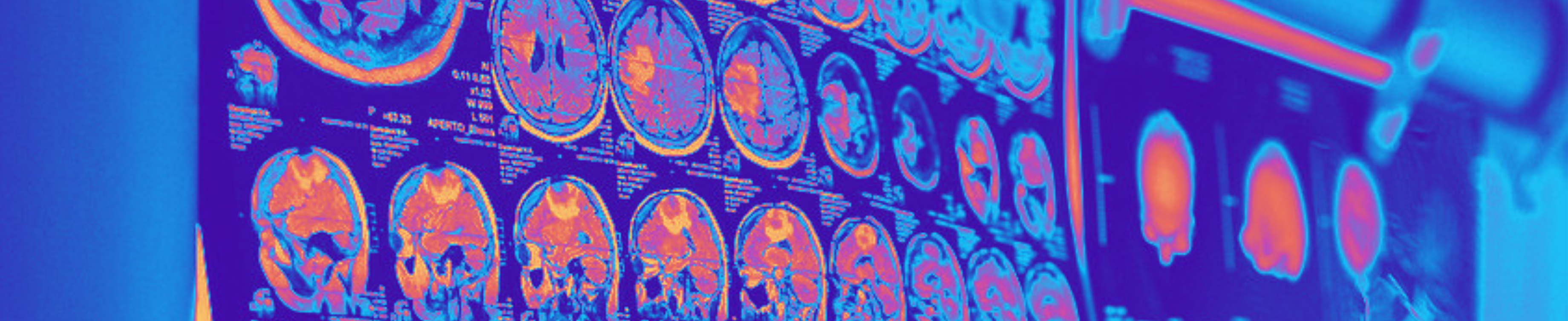 Head scan images