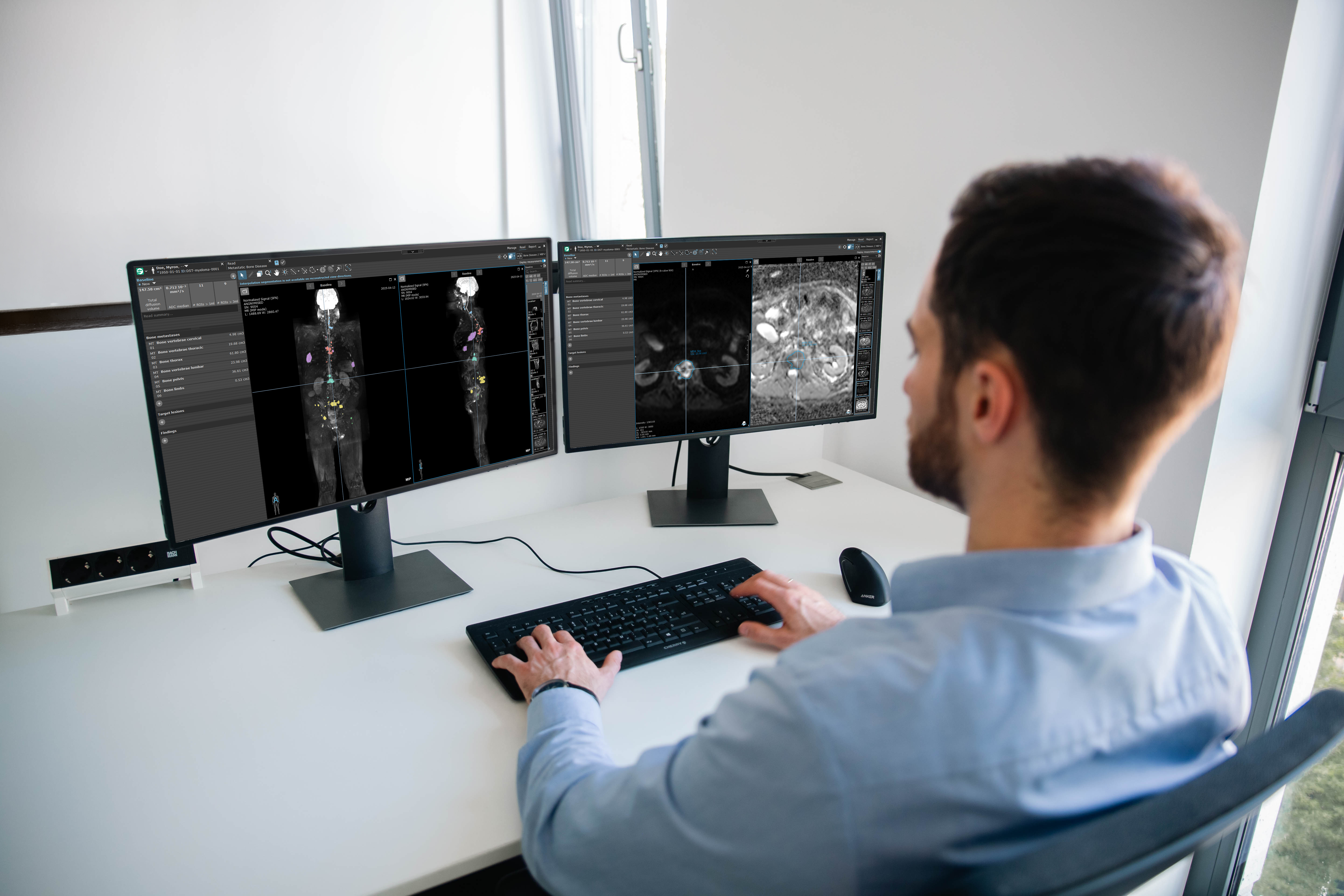 A man looking at a computer screen showing MRI images of bone lesions in myeloma