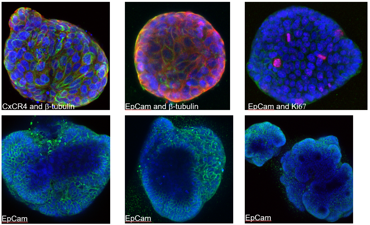 Six confocal microscope images of colorectal cancer organoids under immunofluorescence