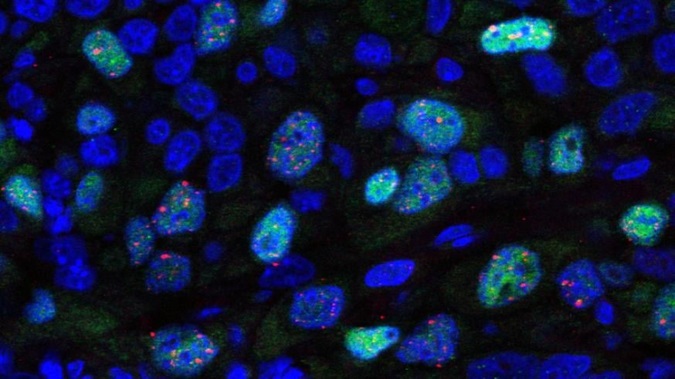 Image showing double-stranded DNA repair following radiation in breast tumours (photo: Frances Daley/Dave Robertson)