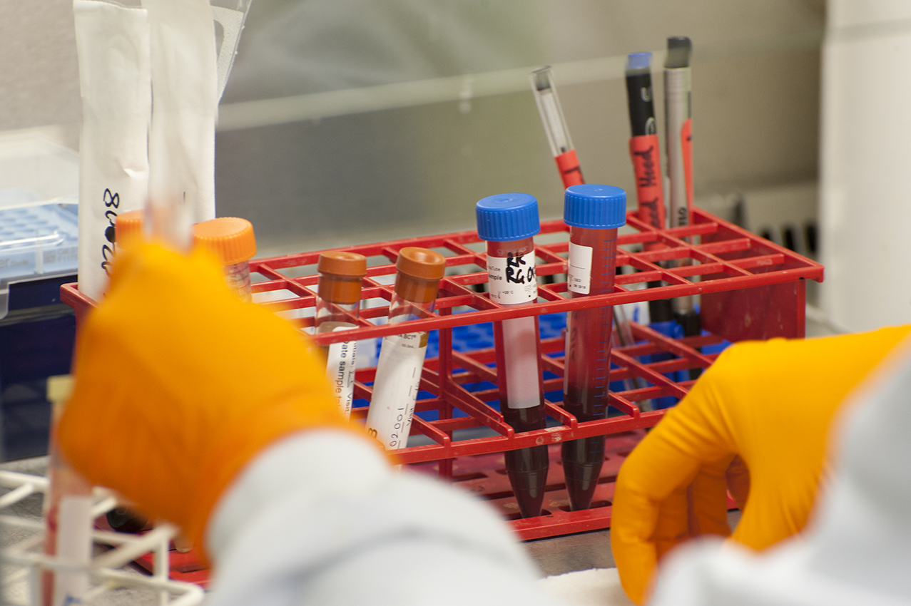 Blood test samples Gloved hands arranging test tubes containing blood in a test-tube rack in a lab