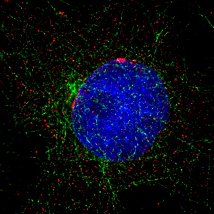 A fluorescence microscope image of Xenopus cancer kidney cells in interphase