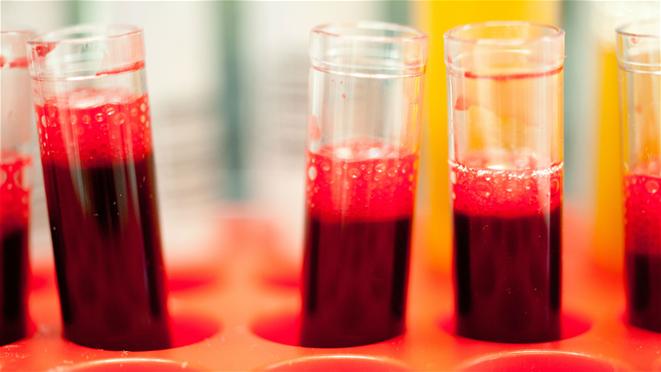 Blood samples in tubes 661x372 Blood samples in tubes