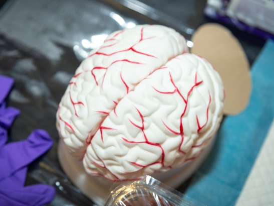 Brain model - 547x410 A brain model