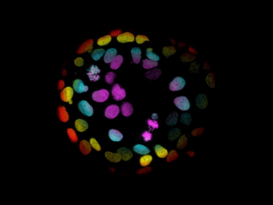 Colorectal cells grown into organoids - Hubrecht Organoid Technology 547x410 Colorectal cells grown into organoids, coloured red, yellow, blue and purple