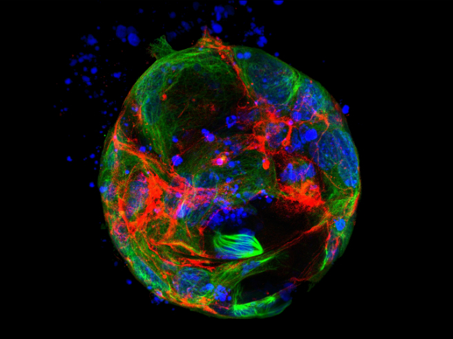 Intestinal organoid crop - 656x491 Intestinal organoid crop