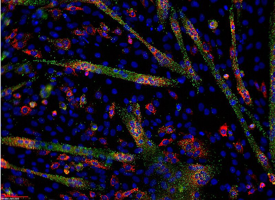 microRNA microRNA
