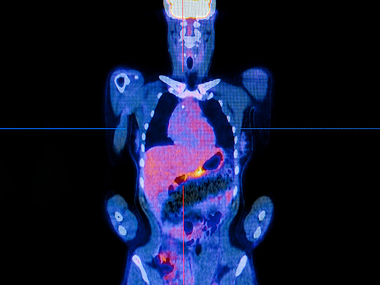 pet-scan content pet-scan content