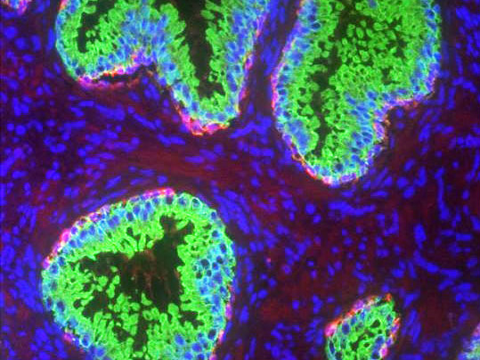 Prostate Gland Prostate Gland