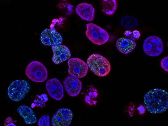 Strategy 2022-27 Research theme 1 - Unravel the cancer ecosystem 547x410 Cells under the microscope