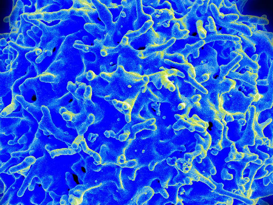 t-cell rhs t-cell rhs