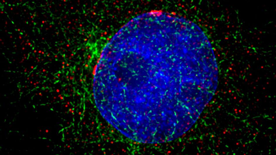 Xenopus cancer kidney cells interphase Paul Andrews 945x532 Xenopus cancer kidney cells interphase Paul Andrews 945x532