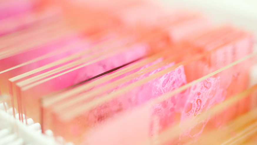 Cell samples on a microscope slide