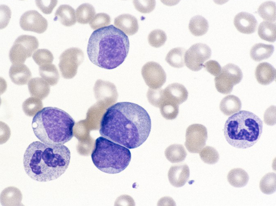 ChronicMyeloidLeukaemia_WellcomeImages_540x404 Chronic myeloid leukaemia cells, image used form Wellcome Image Library