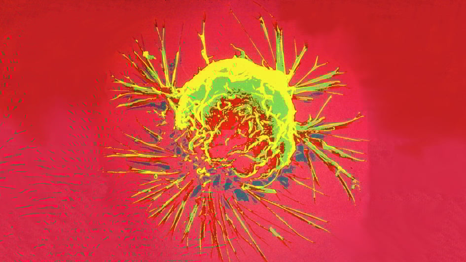 breast-cancer-cellebea14cb659564f3a772ff0000325351 Celleba of Breast Cancer