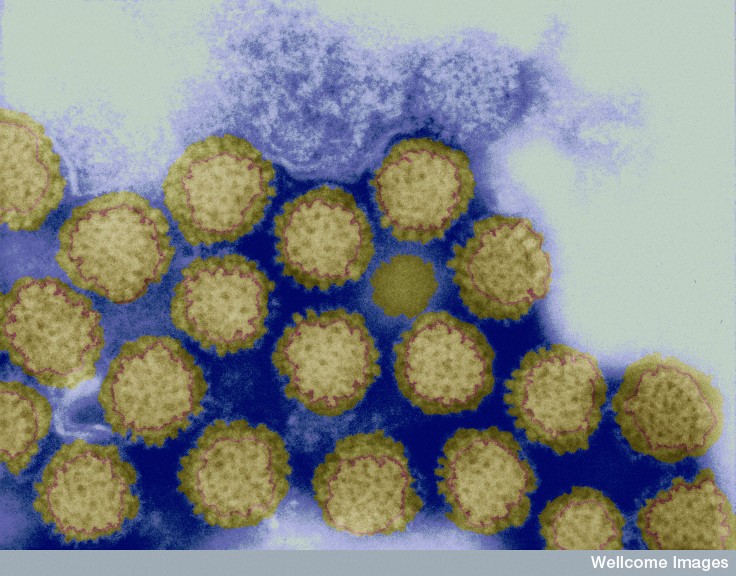 Reovirus - Wellcome Library, London Reovirus - Wellcome Library, London