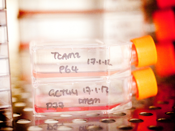 cellcultures_540x404 Cell cultures incubating