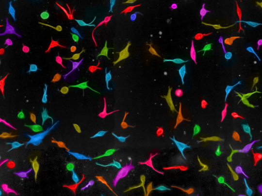 Melanoma cells_ChrisBakal_ICR_2015_540x404 Melanoma cells, Dr ChrisBakal, ICR, 2015