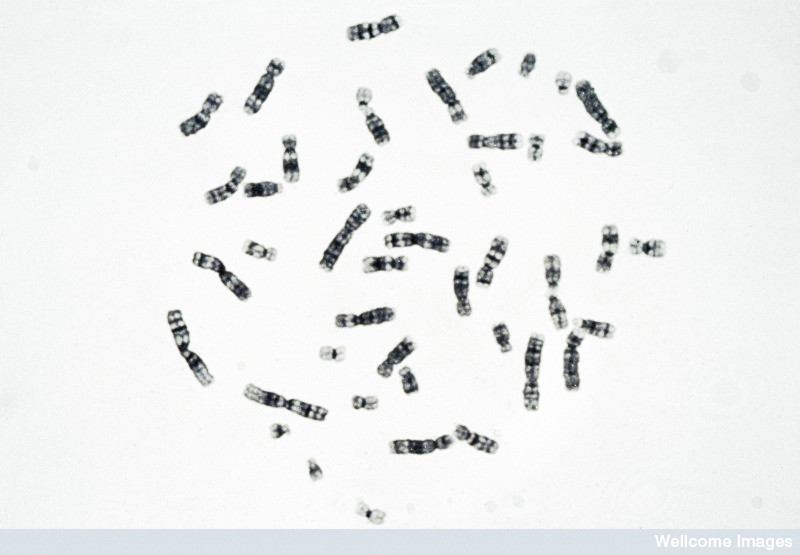 Normal human male metaphase, Y banding. Wessex Reg. Genetics Centre, Wellcome Images / Creative Commons by-nc-nd 2.0 UK Normal human male metaphase, Y banding. Wessex Reg. Genetics Centre, Wellcome Images / Creative Commons by-nc-nd 2.0 UK