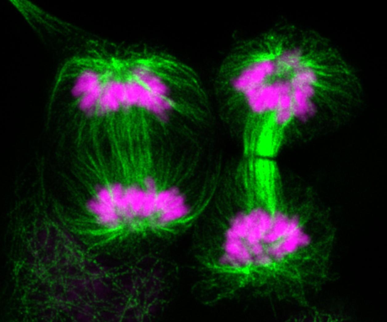 Dr Maria Taskinen Image Science Competition tubulin DAPI lung cancer Science Image Competition 2025 Tubulin (green) and DAPI (magenta) staining in H2228 lung cancer cells