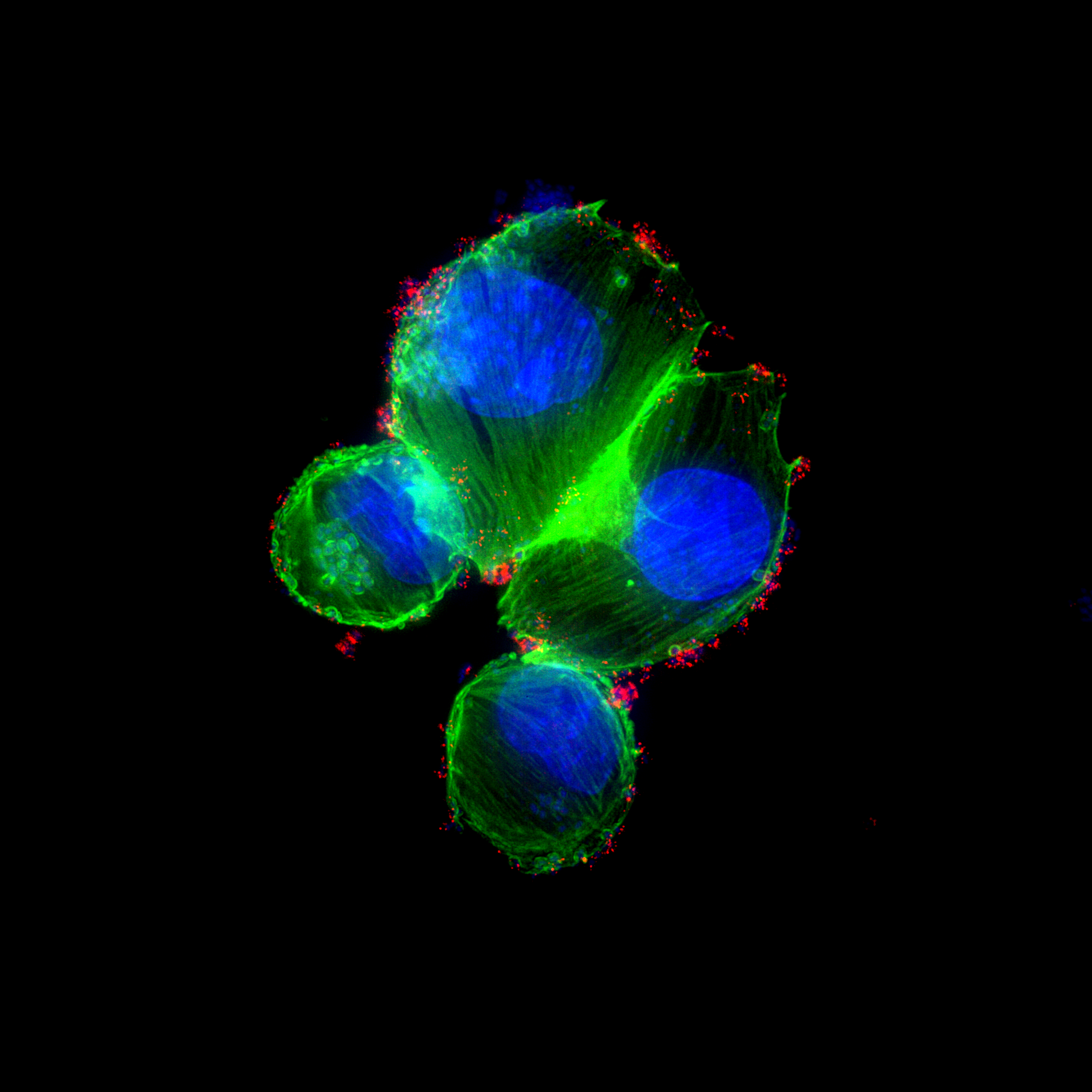 E. coli bacteria engineered with microscopic ‘stings’ to deliver treatment to pancreatic cancer cells
