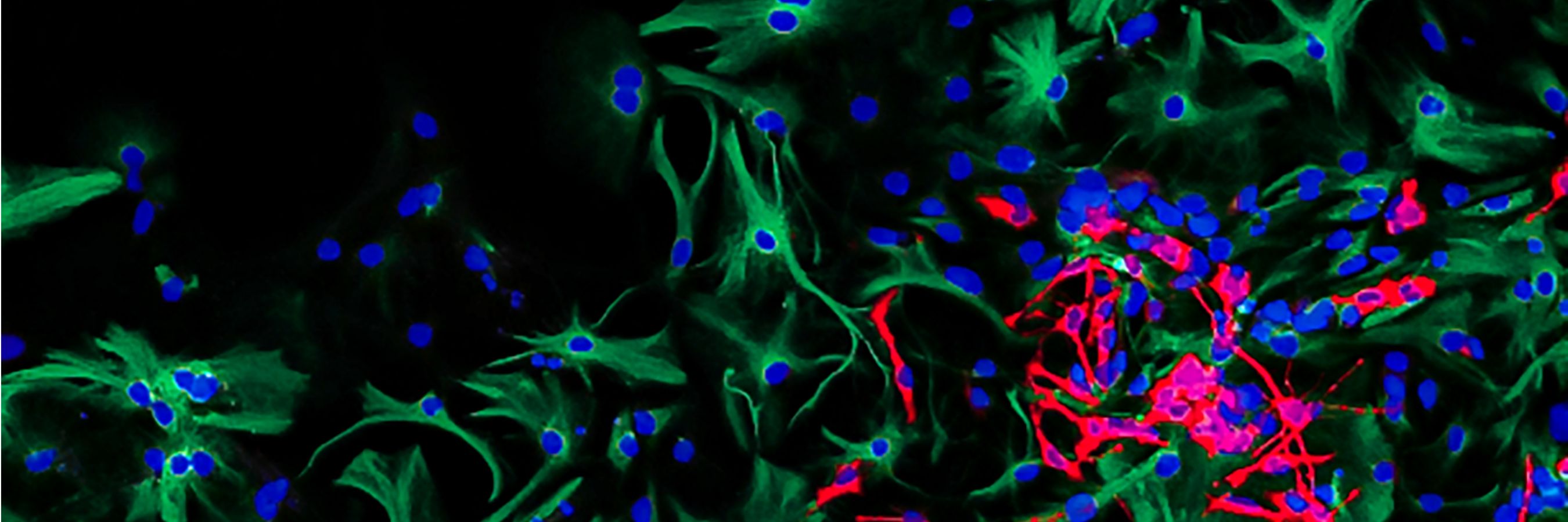 ICR_search_portraits_img2 MRI of a breast